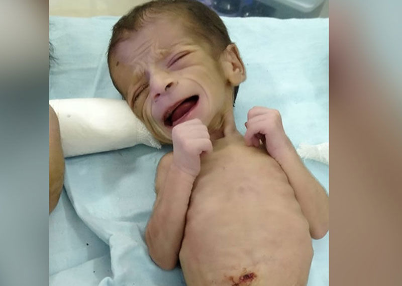 Four-day-old baby girl found buried alive in India